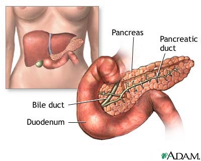 Cancerul pancreasului